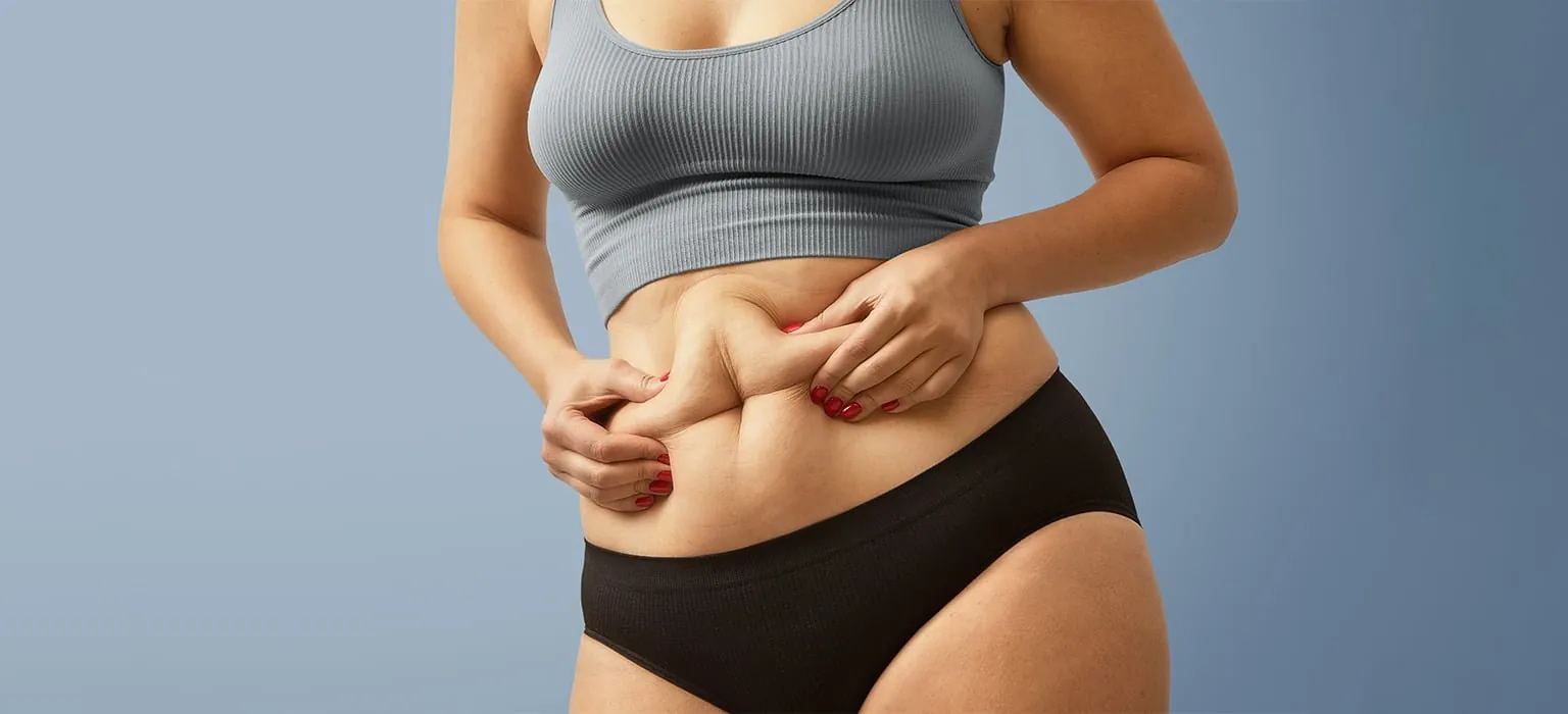 A woman holding the fat on her abdomen