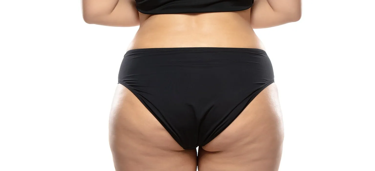 The back of a woman's hips and legs