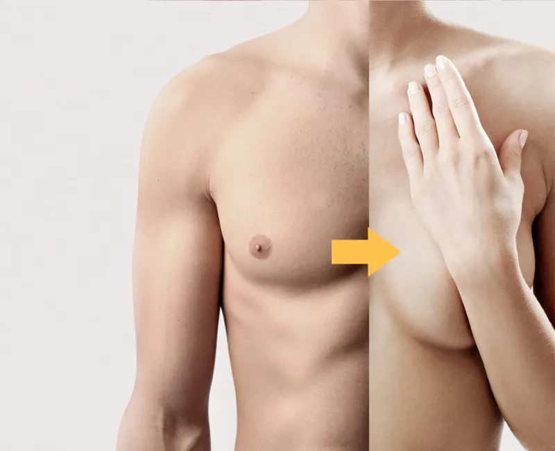 A symbolic image of male-to-female transition