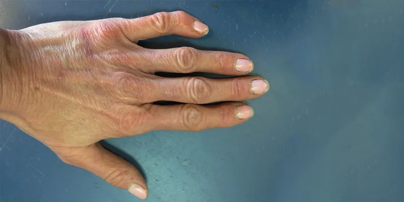 The back of a hand