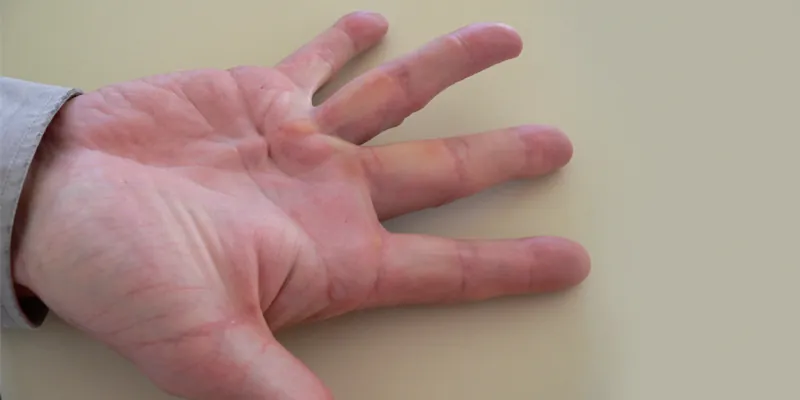 A hand resting palm up