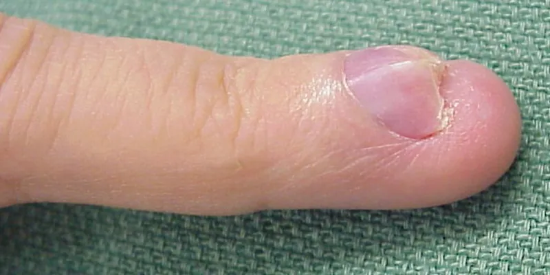 A fingertip and nail