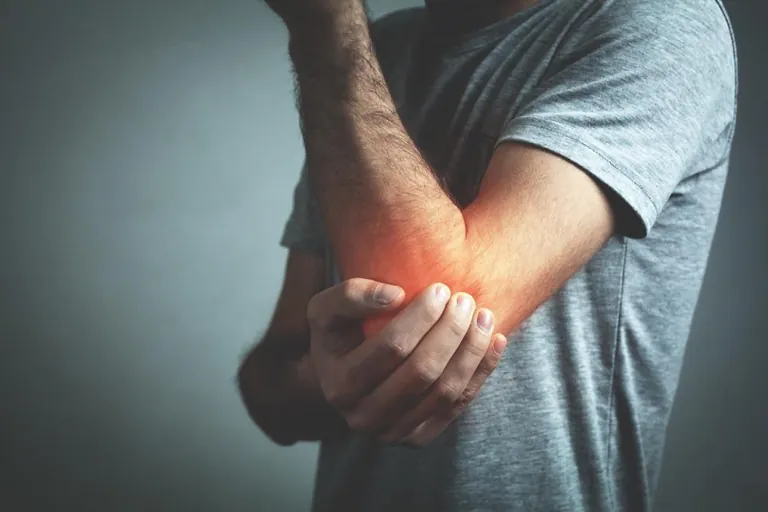 An arm with nerve pain highlighted in the hand
