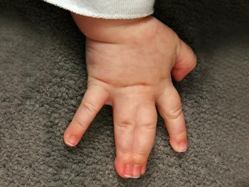A child's hand with joined fingers