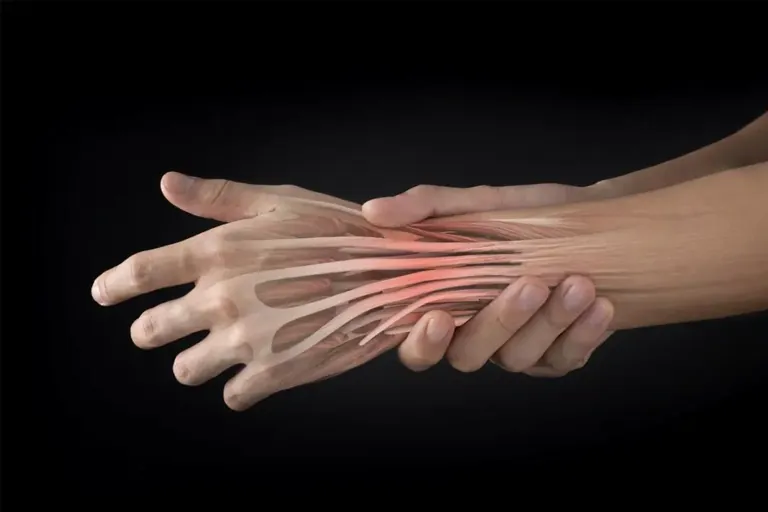 Drawing of the tendons of the hand