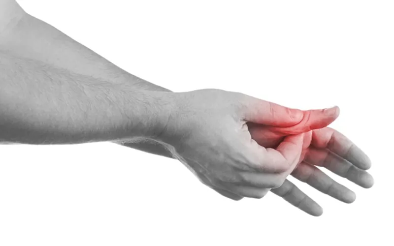 A hand with pain at the base of the thumb